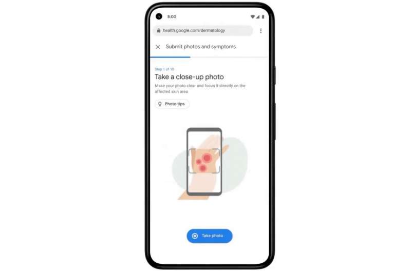 Google aims to use AI to help recognize common skin conditions