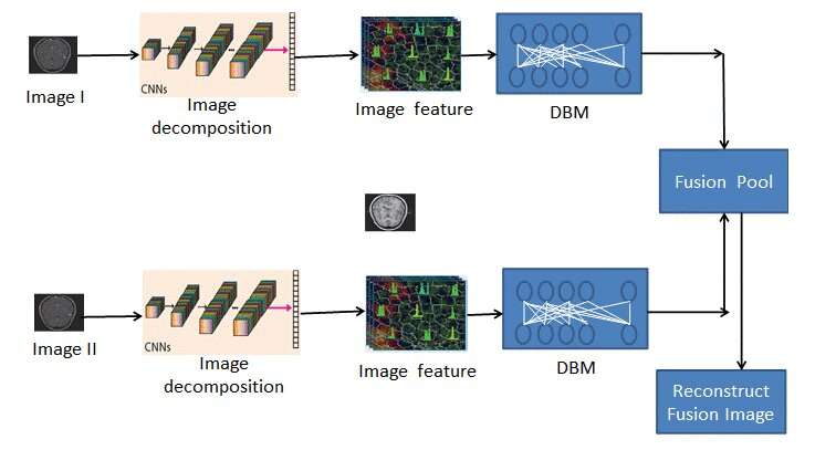 New medical image fusion method draws on deep learning to improve patient outcomes